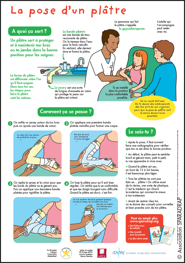 Visuel du poster "La pose d'un plâtre"
