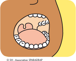 Illustration de l'intérieur de la bouche