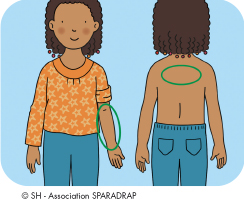 On fait le test sur la peau du bras ou sur la peau du dos