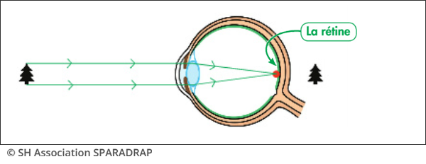 Shéma d'un oeil normal