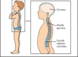 Vue en coupe montrant l'emplacement du liquide cephalo rachidien dans le cerveau et la colonne vertébrale