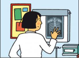 Un médecin regarde une radiographie posée sur un négatoscope