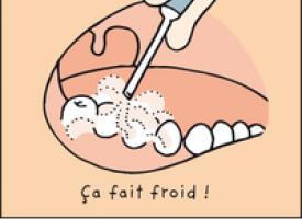 Action d'une soufflette sur des dents