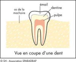 Vue en coupe d'une dent