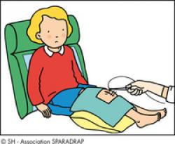 points de suture